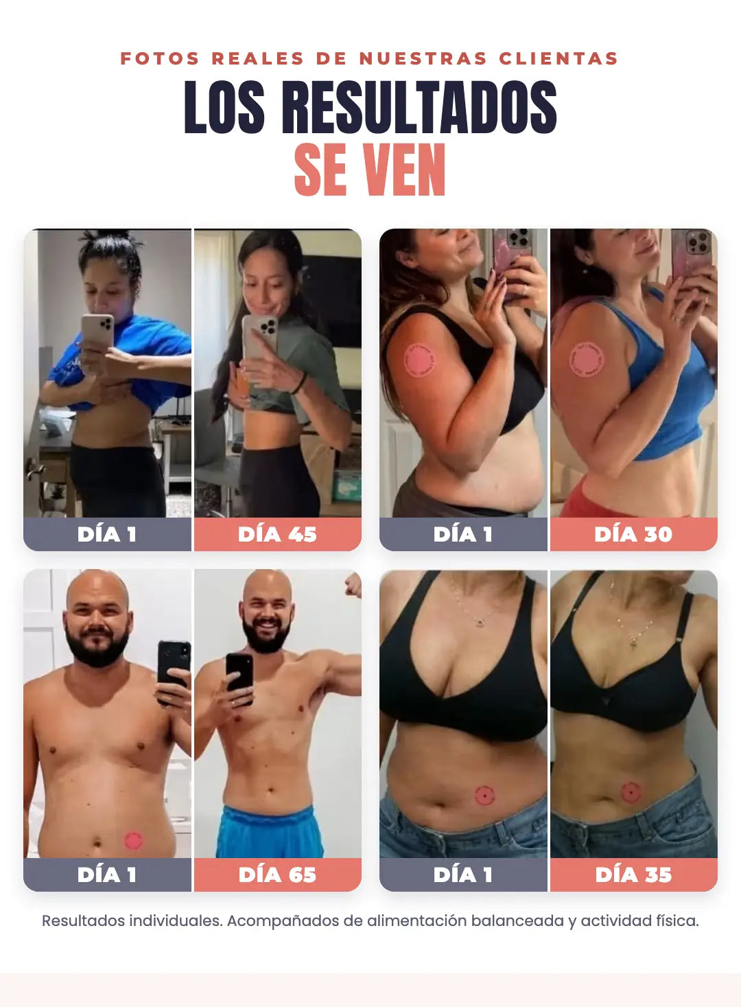 Fotos reales de clientas: antes y después